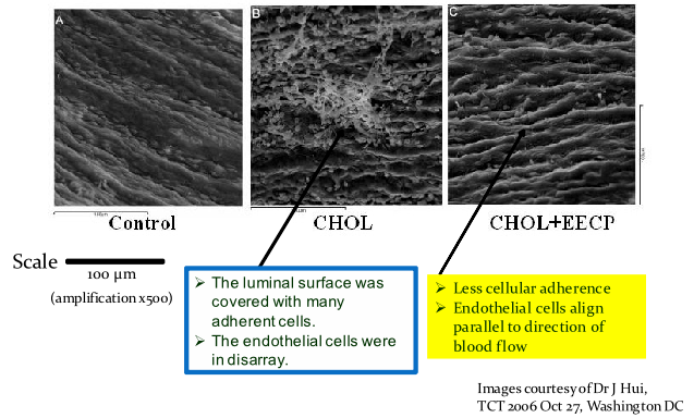 Images of effect to blood vessel endothelial lining